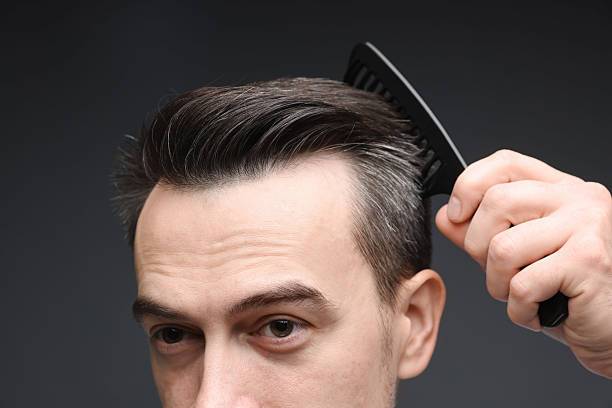 Popular haircut options for men with receding hairlines.